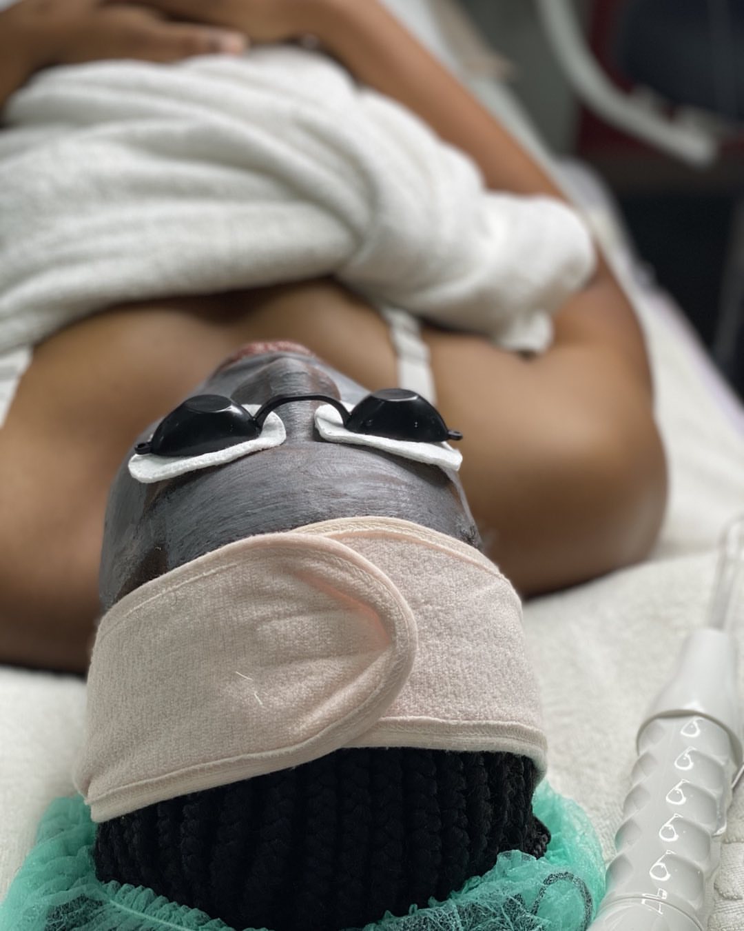 Hydrafacial treatment
